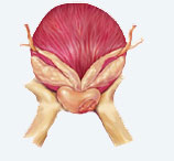 Prostate with tumor illustration